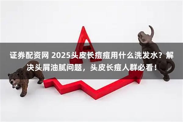 证券配资网 2025头皮长痘痘用什么洗发水？解决头屑油腻问题，头皮长痘人群必看！